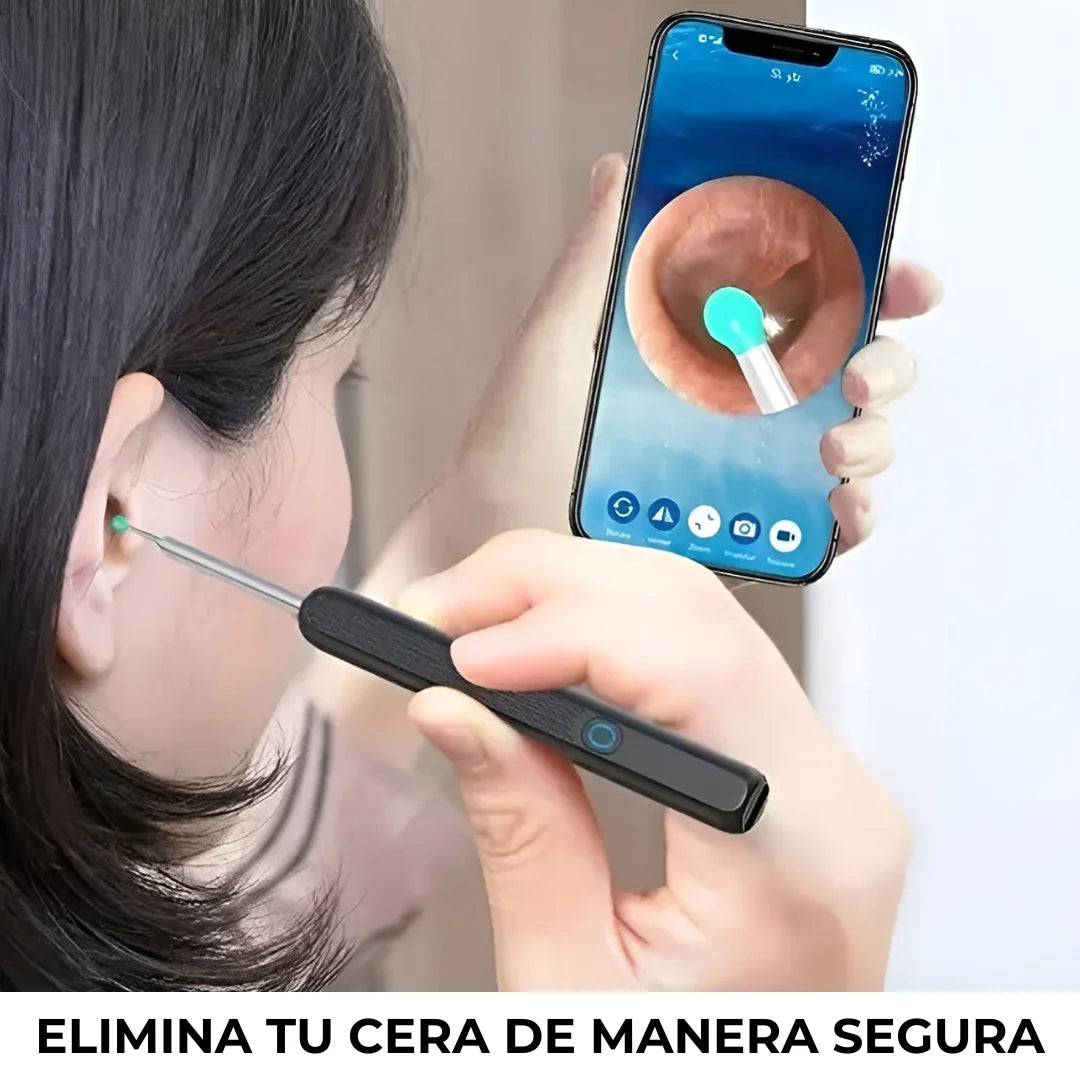 OtoSmart 🔊👂¡Limpieza clara y sin molestias!