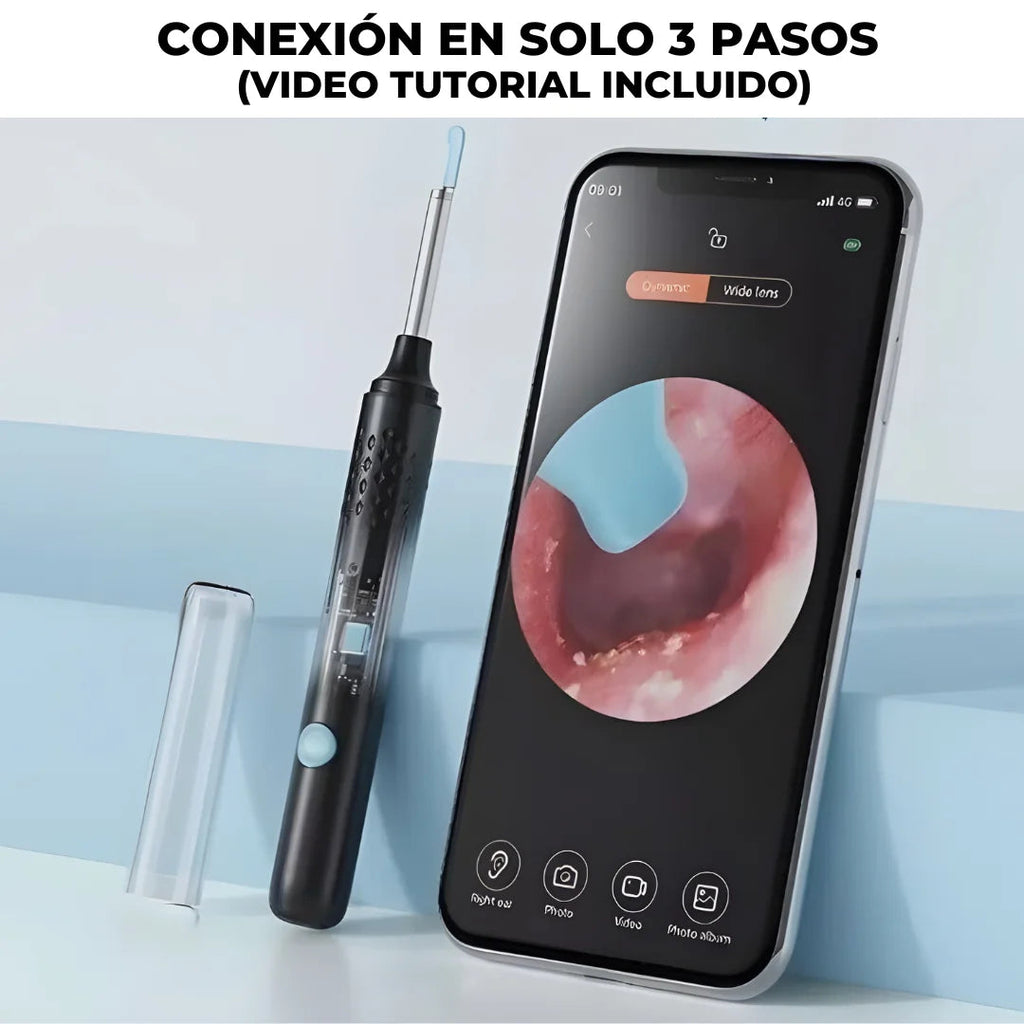 OtoSmart 🔊👂¡Limpieza clara y sin molestias!
