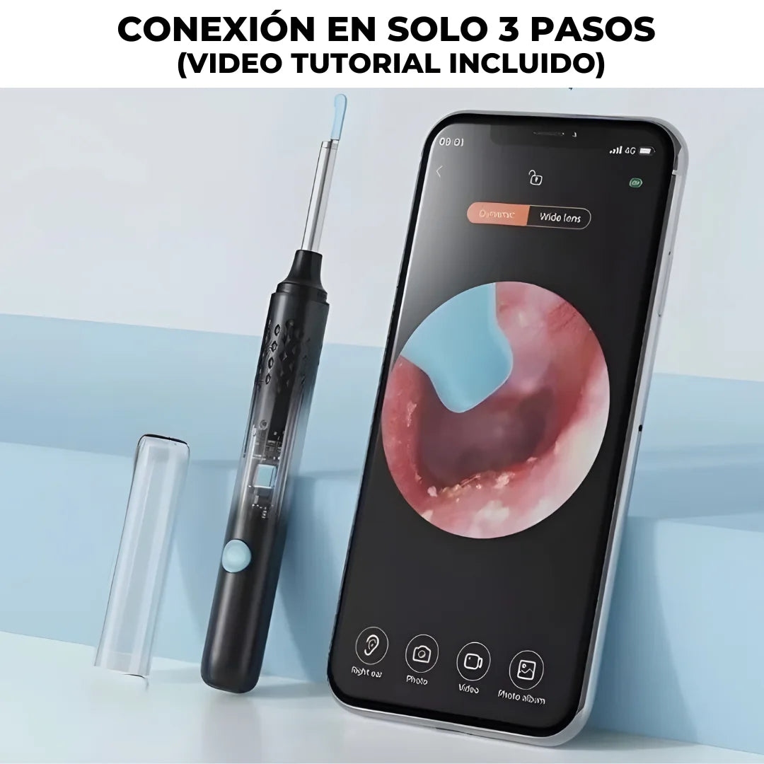 OtoSmart 🔊👂¡Limpieza clara y sin molestias!