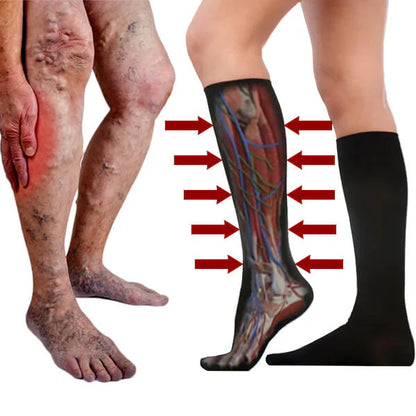 Medias de Compresión 🦵   ¡Reduce dolor, hinchazón y fatiga!✨
