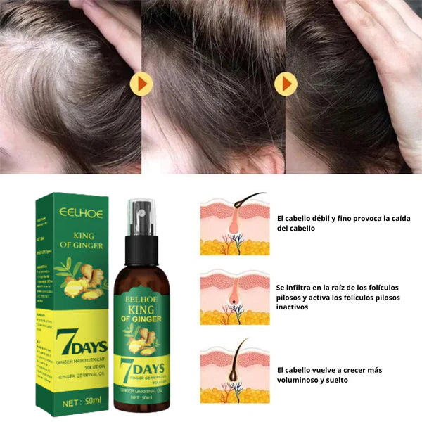 Elixir Capilar 7DAYS🔥🌿 ¡Despídete de la caída, dale vida nueva a tu cabello!