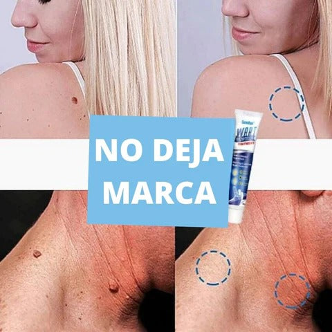 VerruSkin 💉👃 ¡Ayuda a reducir verrugas y acrocordones desde casa!