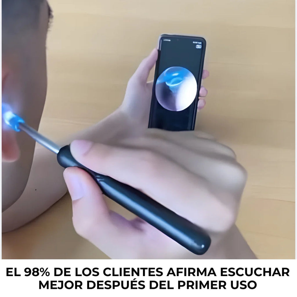 OtoSmart 🔊👂¡Limpieza clara y sin molestias!