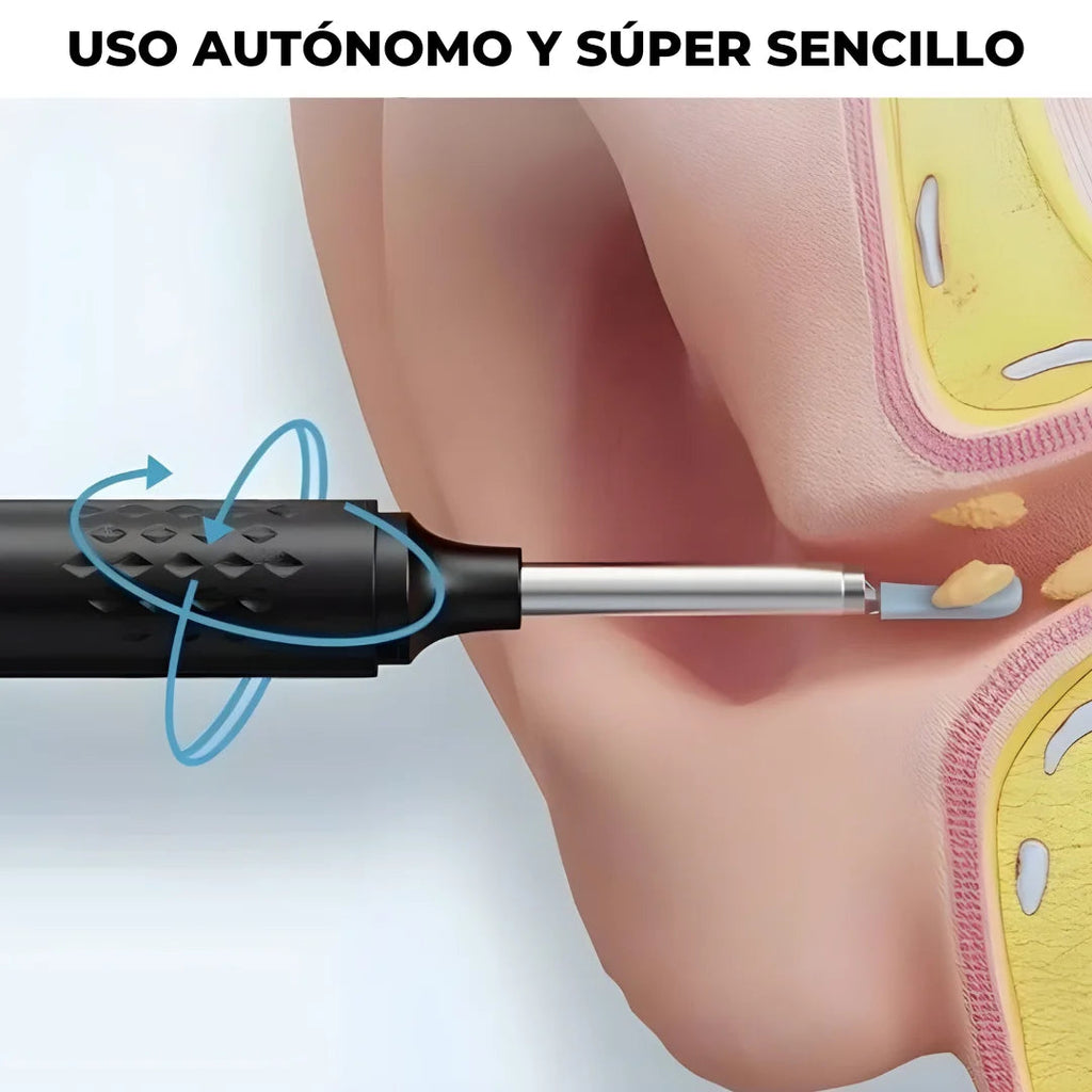 OtoSmart 🔊👂¡Limpieza clara y sin molestias!