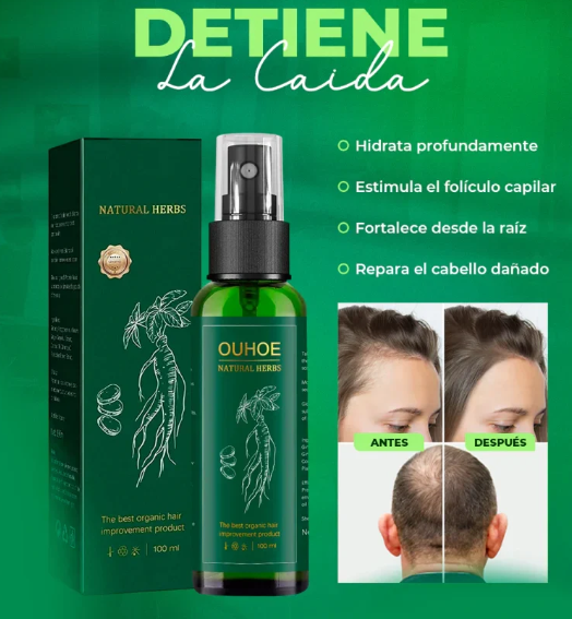 Elixir Capilar 🔥🌿 ¡Despídete de la caída, dale vida nueva a tu cabello!