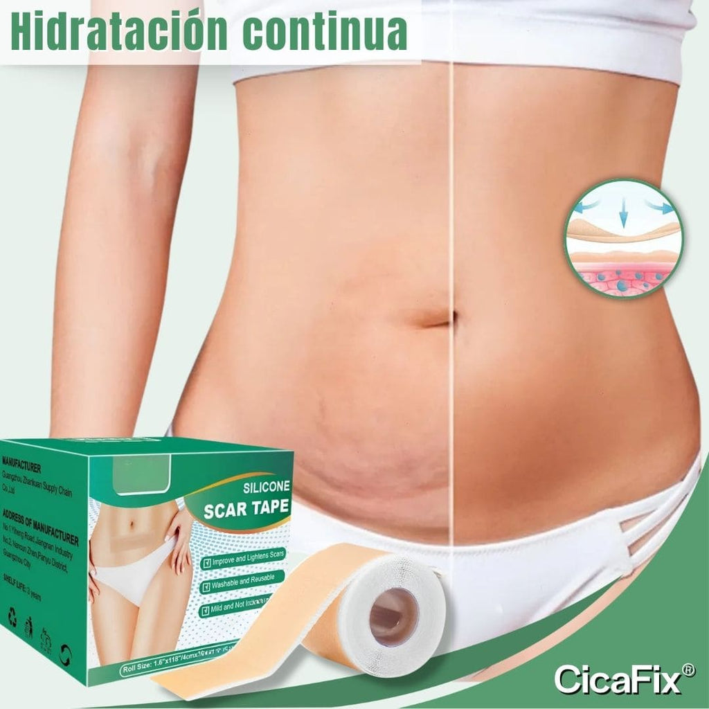 CicaFix 2 X 1 – Rollos Parches Silicon Quita Cicatrices