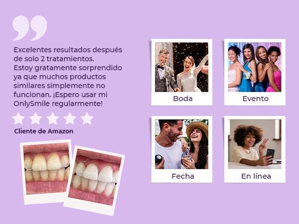 Blanquea Fácil  🦷 ¡Dientes más blancos sin darle color al cepillado!