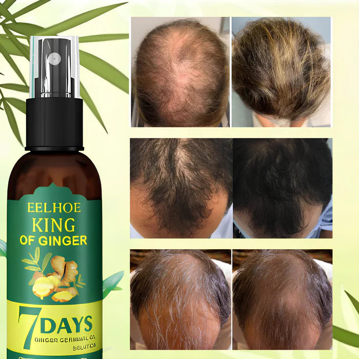 Elixir Capilar 7DAYS🔥🌿 ¡Despídete de la caída, dale vida nueva a tu cabello!